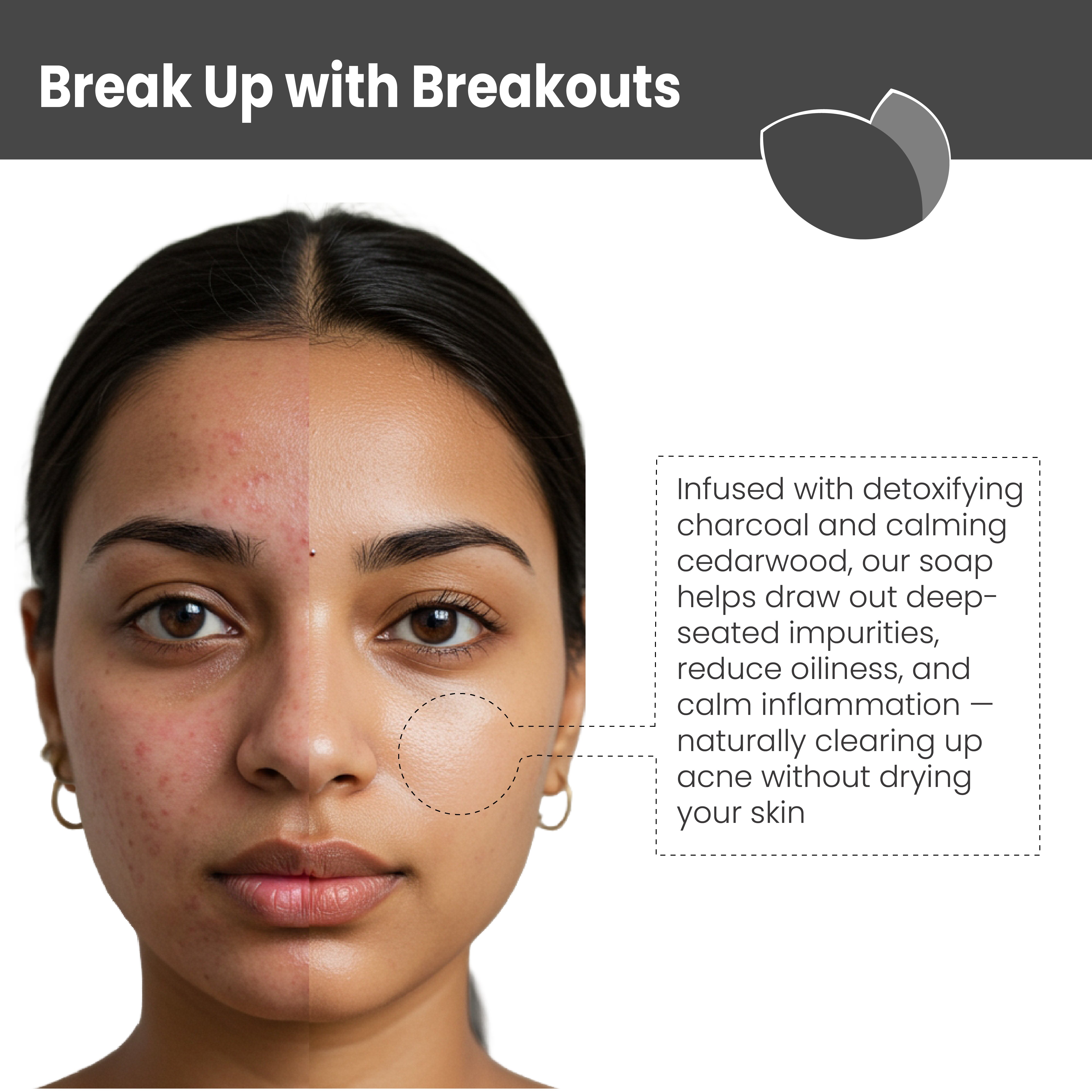 Demonstrating skin benefits: acne control, oil absorption, and detoxification

